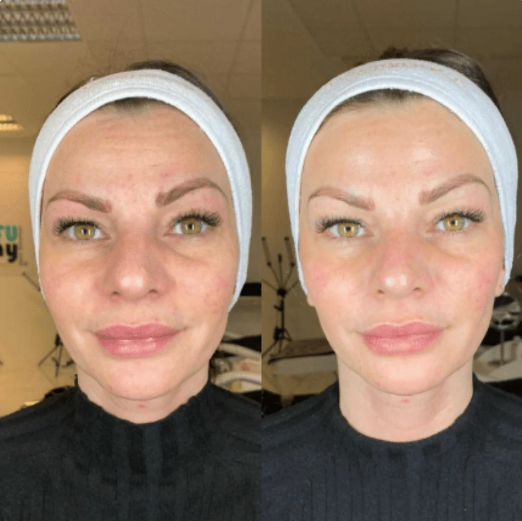 Fiorenza™ Mascarilla Boost De Colageno